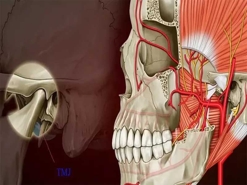 TMJ چیست؟